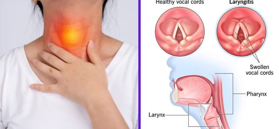 is laryngitis communicable